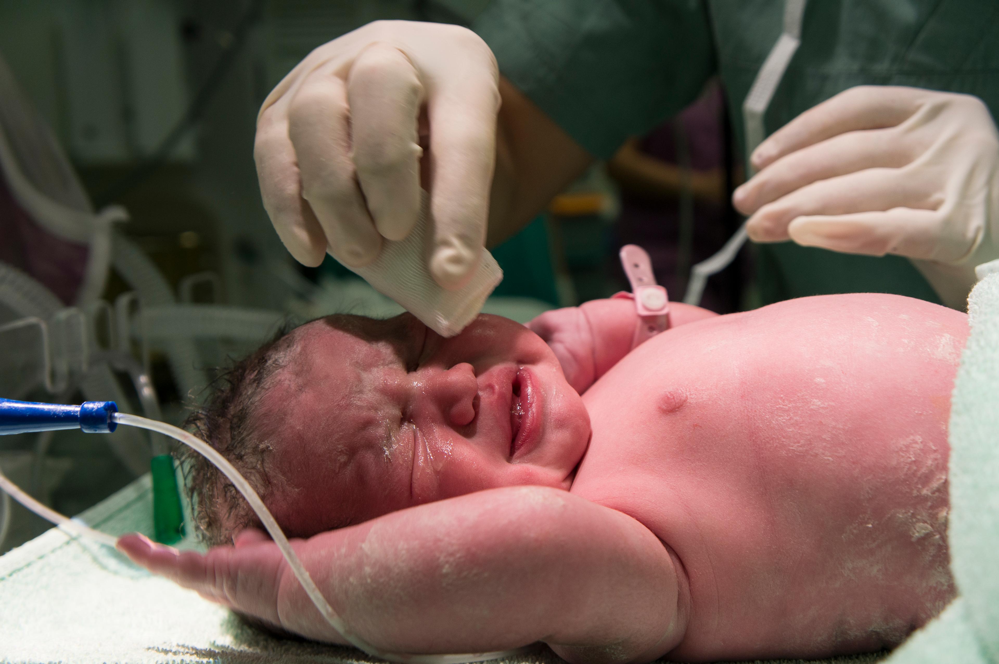 Иркутские врачи спасли новорождённого с нулевым резус-фактором