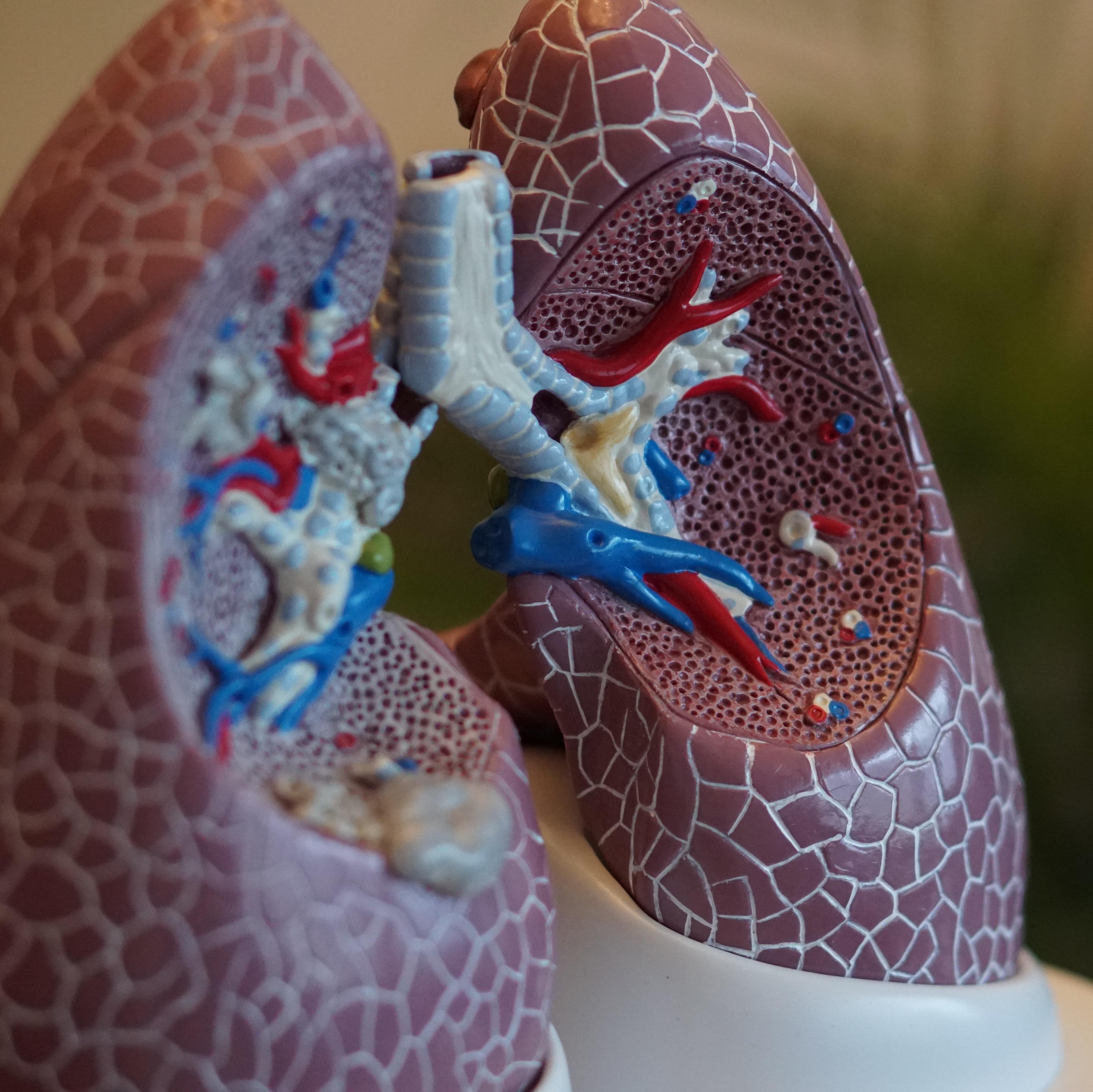 Пульмонолог назвал три главные причины проблем с лёгкими